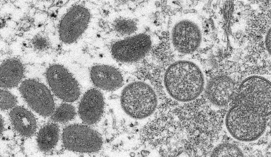 La OMS declara emergencia mundial por un brote de viruela del mono en